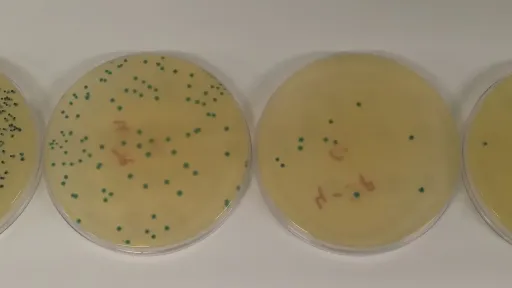 Listeria kolooniad Petri tassidel