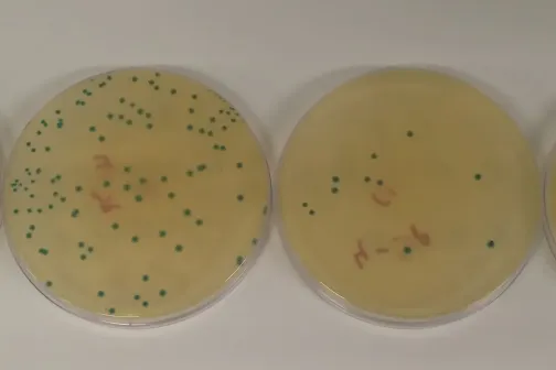 Listeria kolooniad Petri tassidel